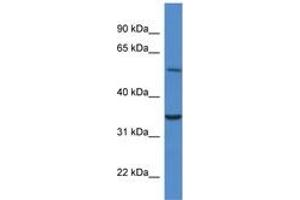 Image no. 1 for anti-Cytochrome B5 Reductase 4 (CYB5R4) (N-Term) antibody (ABIN6746476) (CYB5R4 antibody  (N-Term))