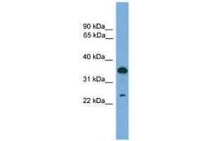 Image no. 1 for anti-Tumor Protein D52 (TPD52) (AA 81-130) antibody (ABIN6745546) (TPD52 antibody  (AA 81-130))