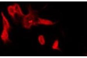 ABIN6278647 staining COLO205 by IF/ICC. (UBTD2 antibody  (C-Term))