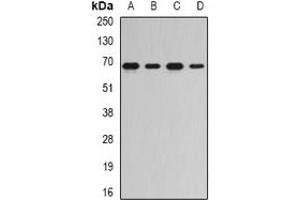 Western blot analysis of RNGTT expression in Jurkat (A), Hela (B), mouse spleen (C), rat kidney (D) whole cell lysates.