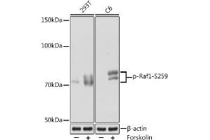 Western blot analysis of extracts of various cell lines, using Phospho-Raf1-S259 Rabbit mAb (ABIN7271265) at 1:1000 dilution. (RAF1 antibody  (pSer259))