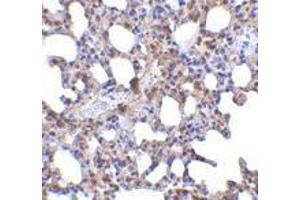 Immunohistochemistry (Paraffin-embedded Sections) (IHC (p)) image for anti-PR Domain Containing 1, with ZNF Domain (PRDM1) (N-Term) antibody (ABIN499477)