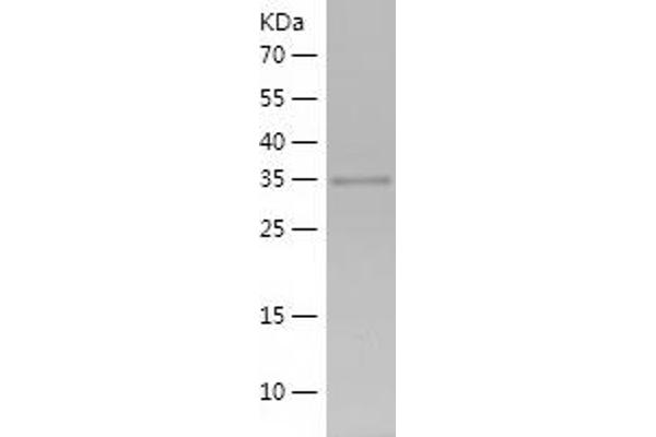 PBX1 Protein (AA 136-430) (His tag)