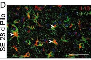 Immunostaining of mouse hippocampal CA1 region showing GFAP and IL1B labeling of astrocytes 28 days after pilocarpine induced status epilepticus (SE). (GFAP antibody  (AA 411-422))