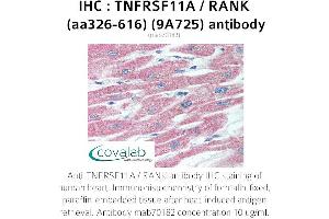 Image no. 1 for anti-Tumor Necrosis Factor Receptor Superfamily, Member 11a, NFKB Activator (TNFRSF11A) (AA 326-616) antibody (ABIN5693688) (TNFRSF11A antibody  (AA 326-616))
