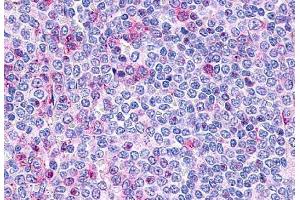 Anti-P2RY10 / P2Y10 antibody  ABIN1049202 IHC staining of human spleen, lymphocytes. (P2RY10 antibody  (Extracellular Domain))