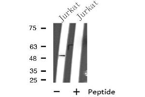 Western blot analysis of extracts from Jurkat cells, using GPR152 antibody. (GPR152 antibody  (N-Term))