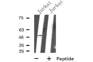 Western blot analysis of extracts from Jurkat cells, using GPR152 antibody.