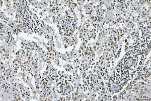 IHC analysis of GADD45B using anti-GADD45B antibody (ABIN7603219). (GADD45B antibody  (N-Term))