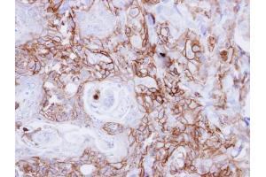 IHC-P Image Immunohistochemical analysis of paraffin-embedded CA922 xenograft, using EGFR, antibody at 1:500 dilution. (EGFR antibody  (N-Term))