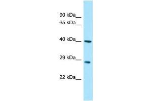 Myozenin 3 anticorps  (C-Term)