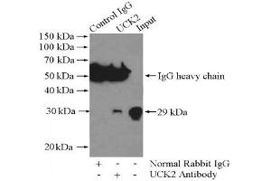Immunoprecipitation analysis of Jurkat cells lysate 400 μg using UCK2 Antibody at a dilution of 1/1000.