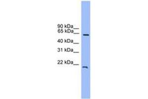 Image no. 1 for anti-Dachshund 1 (DACH1) (C-Term) antibody (ABIN6745356) (DACH1 antibody  (C-Term))