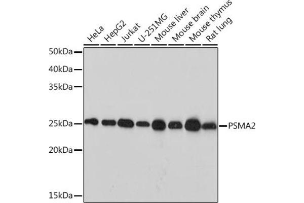 PSMA2 antibody