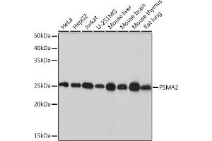 Western blot analysis of extracts of various cell lines, using PSM Rabbit mAb (ABIN7269597) at 1:1000 dilution. (PSMA2 antibody)