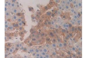 Detection of CBG in Rat Liver Tissue using Polyclonal Antibody to Corticosteroid Binding Globulin (CBG) (SERPINA6 antibody  (AA 267-390))