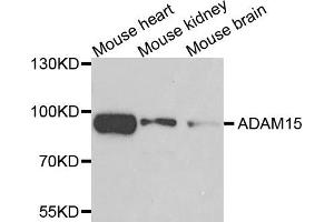 Western blot analysis of extracts of various cells, using ADAM15 antibody.