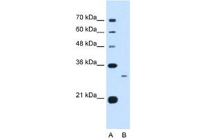 WB Suggested Anti-C1QB Antibody Titration:  0. (C1QB antibody  (C-Term))