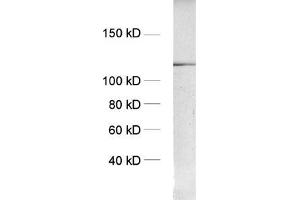 dilution: 1 : 1000, sample: crude synaptosomal fraction of rat brain (P2) (Amphiphysin antibody  (AA 2-15))