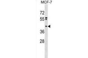 Western Blotting (WB) image for anti-Phosphatidic Acid Phosphatase Type 2 Domain Containing 2 (PPAPDC2) antibody (ABIN2999607)
