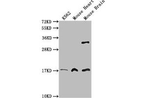 Western Blot Positive WB detected in: K562 whole cell lysate, Mouse heart tissue, Mouse brain tissue All lanes: FUNDC1 antibody at 3 μg/mL Secondary Goat polyclonal to rabbit IgG at 1/50000 dilution Predicted band size: 18 kDa Observed band size: 18 kDa