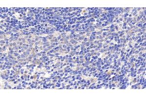 Detection of GRN in Rat Spleen Tissue using Polyclonal Antibody to Granulin (GRN) (Granulin antibody  (AA 44-255))