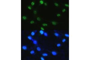 Immunofluorescence analysis of NIH/3T3 cells using Phospho-Histone H3-S28 antibody (ABIN7267689) at dilution of 1:100.