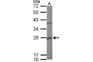 WB Image Sample (50 ug of whole cell lysate) A: mouse heart 12% SDS PAGE antibody diluted at 1:10000 (KCNMB1 antibody  (Center))
