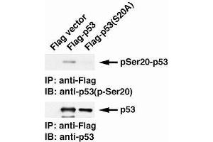 Western Blotting (WB) image for anti-Tumor Protein P53 (TP53) (pSer20) antibody (ABIN3201004)