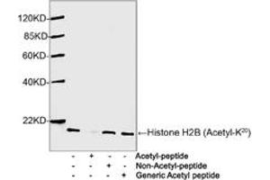 Western blot analysis of Hela cell lysates using 1 µg/mL Antibodies-Online Rabbit Anti-Histone H2B (Acetyl-K20) Polyclonal Antibody (ABIN398911) The signal was developed with IRDyeTM 800 Conjugated Goat Anti-Rabbit IgG. (Histone H2B antibody  (Lys20))