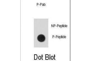 Dot Blot (DB) image for anti-Signal Transducer and Activator of Transcription 5A (STAT5A) (pSer726) antibody (ABIN5021402) (STAT5A antibody  (pSer726))