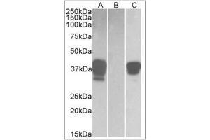 HEK293 lysate (10 µg protein in RIPA buffer) overexpressing Human POU2AF1 with DYKDDDDK tag probed with POU2AF1 Antibody  (1 µg/ml) in Lane A and probed with anti-DYKDDDDK Tag (1/3000) in Lane C.
