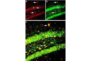 Multiplex staining of Kir6. (BDNF antibody  (Intracellular))