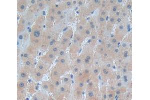 Used in DAB staining on fromalin fixed paraffin- embedded liver tissue (HARS1/Jo-1 antibody  (AA 1-294))