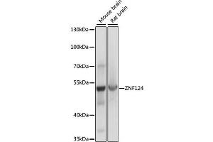 Western blot analysis of extracts of various cell lines, using ZNF124 antibody (ABIN7271452) at 1:1000 dilution. (ZNF124 antibody  (AA 60-200))
