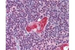 Immunohistochemistry (IHC) image for anti-T-Cell Leukemia Homeobox 1 (TLX1) (AA 300-330) antibody (ABIN2470149)