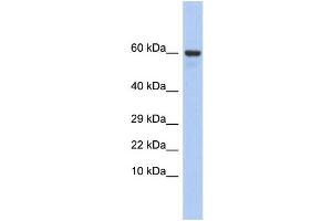 Western Blotting (WB) image for anti-Taxilin gamma (TXLNG) (N-Term) antibody (ABIN2785688) (Taxilin gamma (TXLNG) (N-Term) antibody)
