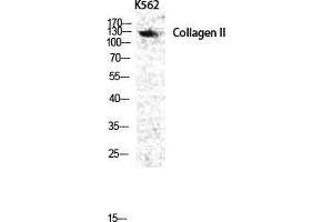 Western Blot (WB) analysis of specific cells using COL2A1 Polyclonal Antibody. (COL2A1 antibody  (N-Term))