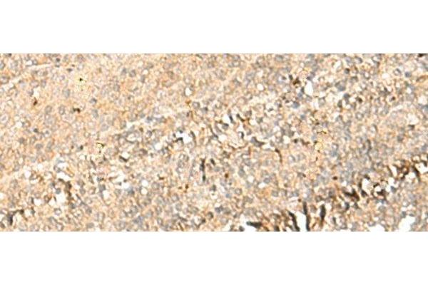 PSD4 antibody