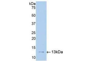 Detection of Recombinant uPAR, Human using Polyclonal Antibody to Plasminogen Activator, Urokinase Receptor (uPAR) (PLAUR antibody  (AA 13-114))