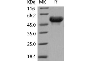 Western Blotting (WB) image for Arylsulfatase A (ARSA) (Active) protein (His tag) (ABIN7320436) (Arylsulfatase A Protein (ARSA) (His tag))