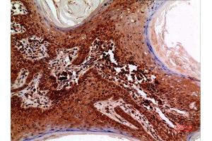 Immunohistochemistry (IHC) analysis of paraffin-embedded Human Skin, antibody was diluted at 1:100. (RFC1 antibody  (C-Term))