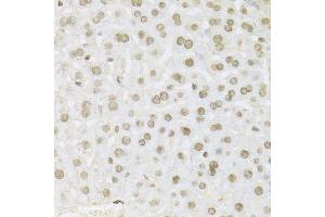 Immunohistochemistry (Paraffin-embedded Sections) (IHC (p)) image for anti-Mitogen-Activated Protein Kinase 3 (MAPK3) (AA 1-100) antibody (ABIN3020725)
