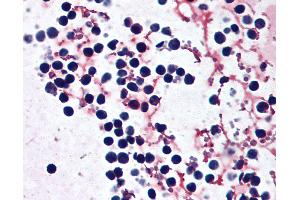 Anti-NLRP3 antibody IHC of human peripheral blood leukocytes. (NLRP3 antibody  (AA 82-93))