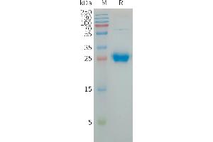 SDS-PAGE (SDS) image for Coxsackie Virus and Adenovirus Receptor (CXADR) (AA 20-237) protein (His tag) (ABIN7491407)