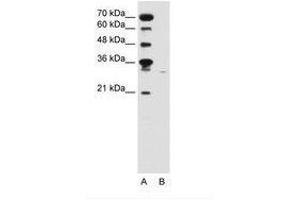 Image no. 2 for anti-Solute Carrier Family 22 (Organic Cation Transporter), Member 7 (SLC22A7) (C-Term) antibody (ABIN6736645) (SLC22A7 antibody  (C-Term))