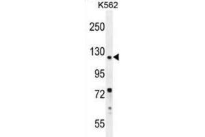 Western Blotting (WB) image for anti-DEAD/H (Asp-Glu-Ala-Asp/His) Box Polypeptide 11 (DDX11) antibody (ABIN2996253) (DDX11 antibody)