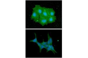 ICC/IF analysis of IMPA1 in Hep3B cells line, stained with DAPI (Blue) for nucleus staining and monoclonal anti-human IMPA1 antibody (1:100) with goat anti-mouse IgG-Alexa fluor 488 conjugate (Green). (IMPA1 antibody)