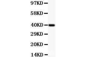 Anti-MCL1 Picoband antibody,  All lanes: Anti MCL1  at 0. (MCL-1 antibody  (AA 1-350))