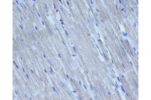 ABIN6276298 at 1/200 staining rat heart tissue sections by IHC-P. (Caspase 3 antibody  (N-Term))